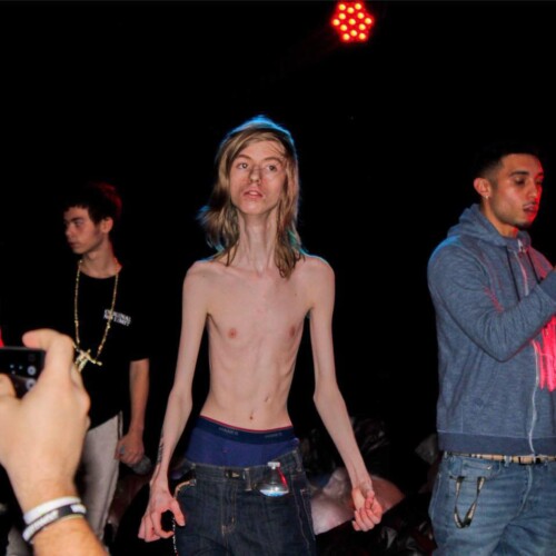 TikTok Star “Daddy Long Neck” David Samuelson Jr. Dies at 26; Fans Mourn the Loss of Viral Personality